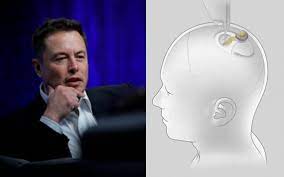 Elon Musk implantará un chip en cerebros humanos