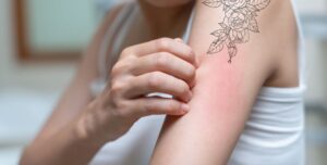 REMOCIÓN DE TATUAJES: ADVIERTEN SOBRE LOS EFECTOS DE LA TINTA Y EXPLICAN CÓMO ES EL PROCESO ACTUAL