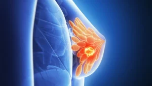 DETECCIÓN PRECOZ Y CONTROLES: LAS CLAVES PARA PREVENIR EL CÁNCER DE MAMA